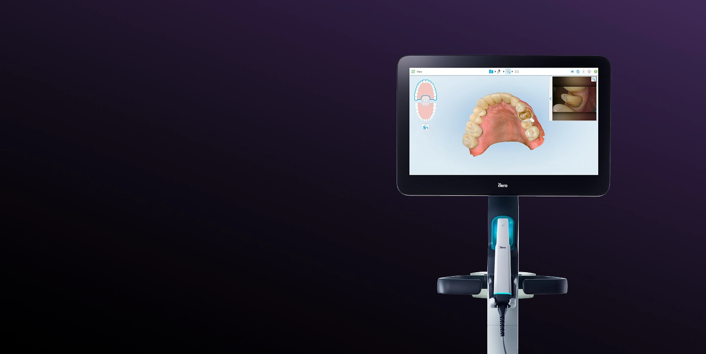 iTero Lumina intraoral scanner with 3D digital model displayed on screen