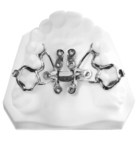 Tiger Screw MARPE 1 — palatal expander device front view, used for non-surgical skeletal expansion at Vivian Lee Orthodontics