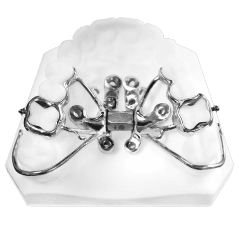 Tiger Screw MARPE 4 — MARPE maxillary expander device detail view showing palatal arch and activation key port